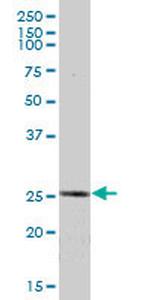 ETHE1 Antibody in Western Blot (WB)