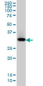 QPRT Antibody in Western Blot (WB)