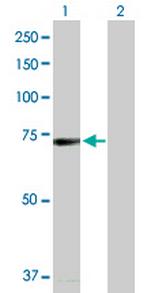 BRD4 Antibody in Western Blot (WB)