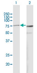 PES1 Antibody in Western Blot (WB)