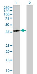 TGDS Antibody in Western Blot (WB)