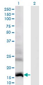 DAAM2 Antibody in Western Blot (WB)