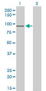 ZNF281 Antibody in Western Blot (WB)