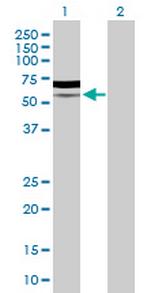 PIK3R5 Antibody in Western Blot (WB)