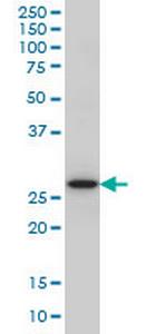 CASP14 Antibody in Western Blot (WB)