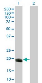 SMUG1 Antibody in Western Blot (WB)