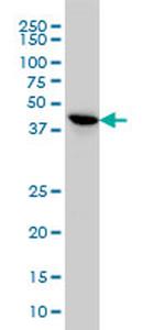 TSSK2 Antibody in Western Blot (WB)