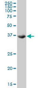 TSSK2 Antibody in Western Blot (WB)