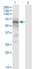 BACE1 Antibody in Western Blot (WB)