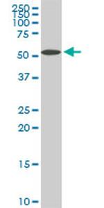 NUP62 Antibody in Western Blot (WB)