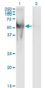 NUP62 Antibody in Western Blot (WB)