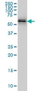 NUP62 Antibody in Western Blot (WB)