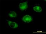 RABGAP1 Antibody in Immunocytochemistry (ICC/IF)