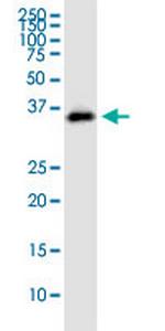 STX12 Antibody in Western Blot (WB)