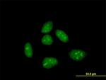 CRI1 Antibody in Immunocytochemistry (ICC/IF)