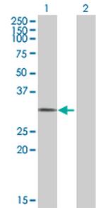 CRI1 Antibody in Western Blot (WB)