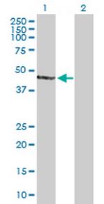 AIPL1 Antibody in Western Blot (WB)