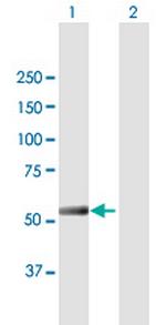 IFIT5 Antibody in Western Blot (WB)