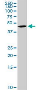 QPCT Antibody in Western Blot (WB)