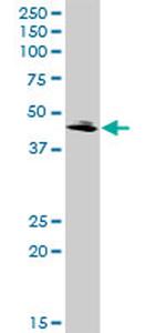 QPCT Antibody in Western Blot (WB)