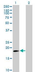 TNFAIP8 Antibody in Western Blot (WB)