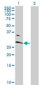 ABHD14A Antibody in Western Blot (WB)