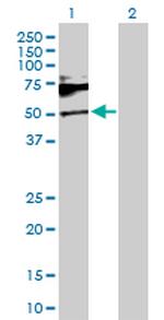 SH2B1 Antibody in Western Blot (WB)