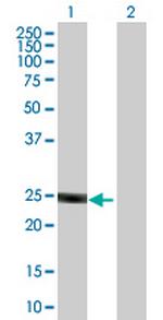 ULK3 Antibody in Western Blot (WB)