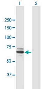 MOXD1 Antibody in Western Blot (WB)