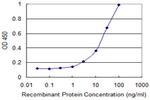 DAK Antibody in ELISA (ELISA)