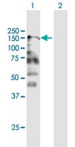 CNTNAP2 Antibody in Western Blot (WB)