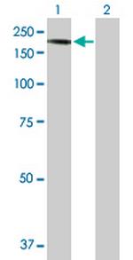 CNTNAP2 Antibody in Western Blot (WB)