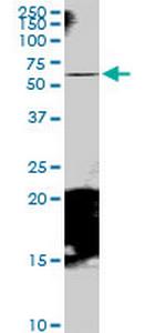 RAB11FIP5 Antibody in Western Blot (WB)