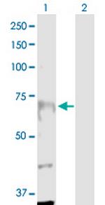 ANKRD17 Antibody in Western Blot (WB)