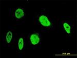 ANKRD17 Antibody in Immunocytochemistry (ICC/IF)