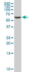 PHGDH Antibody in Western Blot (WB)