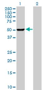 PHGDH Antibody in Western Blot (WB)