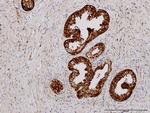 PHGDH Antibody in Immunohistochemistry (Paraffin) (IHC (P))