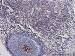 PHGDH Antibody in Immunohistochemistry (Paraffin) (IHC (P))