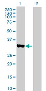 STAP1 Antibody in Western Blot (WB)