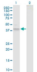 B3GAT3 Antibody in Western Blot (WB)