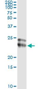 FGF21 Antibody in Immunoprecipitation (IP)