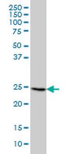 FGF21 Antibody in Western Blot (WB)