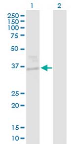 EHF Antibody in Western Blot (WB)