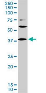 LHX6 Antibody in Western Blot (WB)