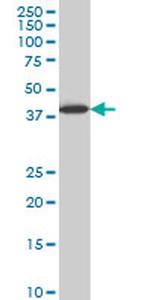 LHX6 Antibody in Western Blot (WB)