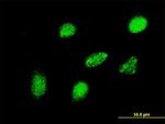 HEYL Antibody in Immunocytochemistry (ICC/IF)