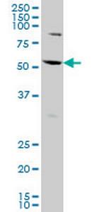 AATF Antibody in Western Blot (WB)