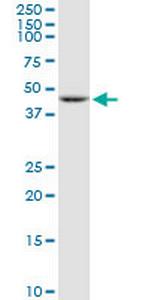 TBL2 Antibody in Western Blot (WB)