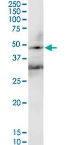 HAVCR1 Antibody in Western Blot (WB)